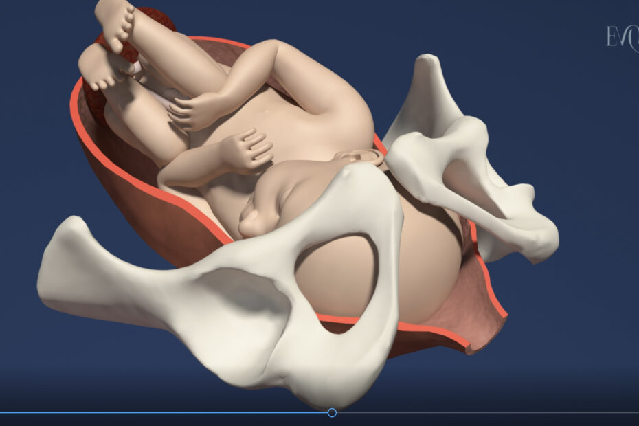 Illustration of a baby at birth